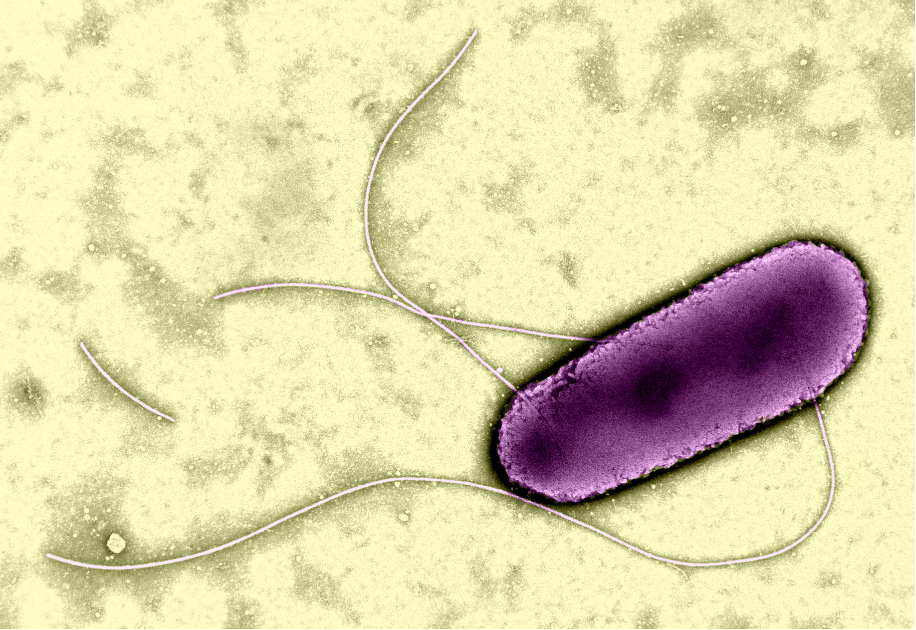 E Coli TEM
